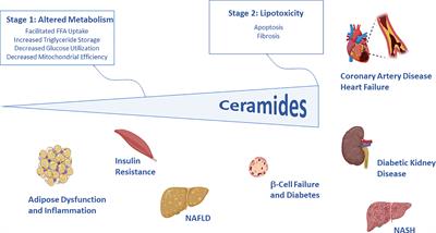 Editorial: The Role of Ceramides in Diabetes and Cardiovascular Disease